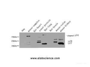 Western Blot analysis of various cells using Cleaved-CASP3 p17 (D175) Polyclonal Antibody at dilution of 1:1000.