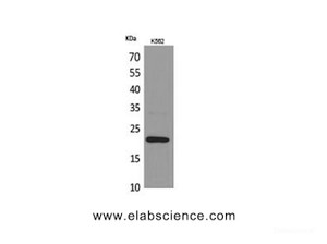 Western Blot analysis of K562 cells using IL6 Polyclonal Antibody at dilution of 1:1000.