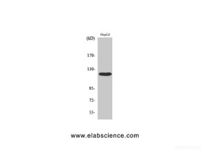 Western Blot analysis of HepG2 cells using FAK Polyclonal Antibody at dilution of 1:500.