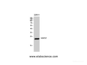 Western Blot analysis of 22RV1 cells using HSP27 Polyclonal Antibody at dilution of 1:1000.