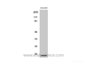 Western Blot analysis of COLO205 cells with Cleaved-CASP3 p17 (D175) Polyclonal Antibody