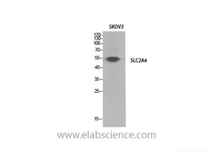 Western Blot analysis of SKOV3 cells using GLUT-4 Polyclonal Antibody at dilution of 1:1000.