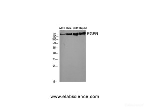 Western Blot analysis of various cells using EGFR Polyclonal Antibody at dilution of 1:2000.