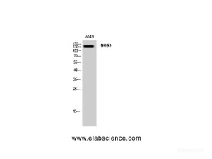 Western Blot analysis of A549 cells using NOS3 Polyclonal Antibody at dilution of 1:1000.