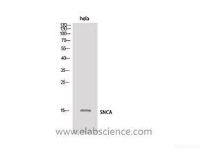 Western Blot analysis of Hela cells using SNCA Polyclonal Antibody.