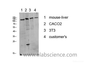 Western Blot analysis of various cells using Phospho-DDR1 (Tyr513) Polyclonal Antibody at dilution of 1:1000.