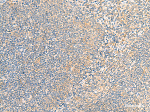 Immunohistochemistry of paraffin-embedded Human tonsil tissue using IFNA5 Polyclonal Antibody at dilution of 1:35 (×200)