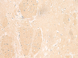 Immunohistochemistry of paraffin-embedded Human brain tissue using IL37 Polyclonal Antibody at dilution of 1:50 (×200)