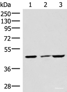 Western blot analysis of HUVEC cell Mouse brain tissue and A549 cell lysates using IP6K2 Polyclonal Antibody at dilution of 1:550