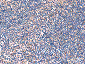 Immunohistochemistry of paraffin-embedded Human tonsil tissue using INPP5B Polyclonal Antibody at dilution of 1:40 (×200)
