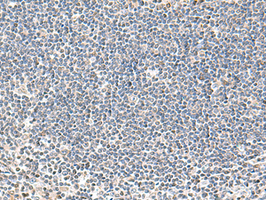 Immunohistochemistry of paraffin-embedded Human tonsil tissue using IFNA2 Polyclonal Antibody at dilution of 1:40 (×200)