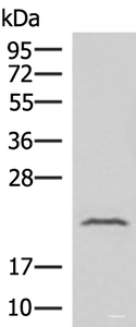 Western blot analysis of Human fetal liver tissue lysate using IFNA8 Polyclonal Antibody at dilution of 1:500