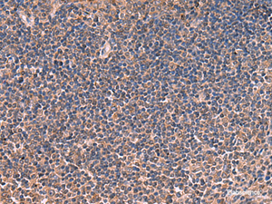 Immunohistochemistry of paraffin-embedded Human tonsil tissue using ITIH4 Polyclonal Antibody at dilution of 1:30 (×200)
