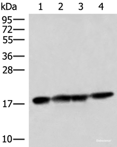 Western blot analysis of 293T HepG2 and Mouse liver tissue lysates using PEMT Polyclonal Antibody at dilution of 1:800