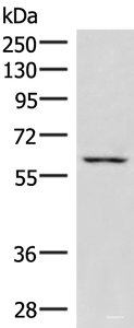 Western blot analysis of K562 cell lysate using JRKL Polyclonal Antibody at dilution of 1:1000