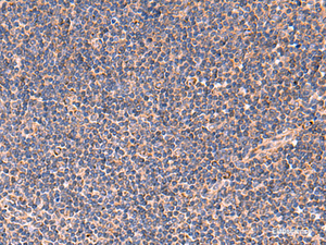 Immunohistochemistry of paraffin-embedded Human tonsil tissue using TNF Polyclonal Antibody at dilution of 1:40 (×200)
