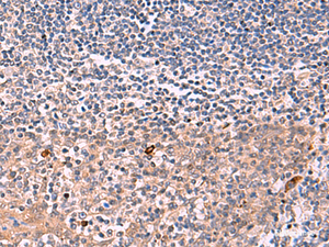 Immunohistochemistry of paraffin-embedded Human tonsil tissue using IFNA1:IFNA13 Polyclonal Antibody at dilution of 1:35 (×200)