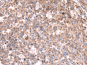 Immunohistochemistry of paraffin-embedded Human tonsil tissue using KBTBD11 Polyclonal Antibody at dilution of 1:35 (×200)