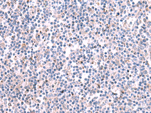 Immunohistochemistry of paraffin-embedded Human tonsil tissue using KCNK10 Polyclonal Antibody at dilution of 1:35 (×200)