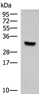 Western blot analysis of Hela cell lysate using KCTD7 Polyclonal Antibody at dilution of 1:1000