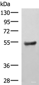 Western blot analysis of Human fetal brain tissue lysate using KDM4D Polyclonal Antibody at dilution of 1:650