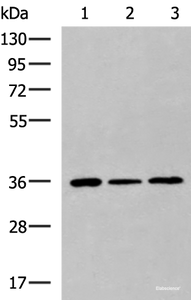 Western blot analysis of HepG2 Hela cell Mouse liver tissue lysates using KHK Polyclonal Antibody at dilution of 1:1000