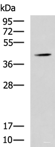 Western blot analysis of Mouse liver tissue lysate using SPI1 Polyclonal Antibody at dilution of 1:1600