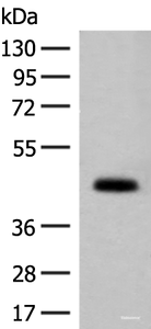 Western blot analysis of Mouse small intestines tissue lysate using GPA33 Polyclonal Antibody at dilution of 1:200