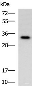 Western blot analysis of Human fetal liver tissue lysate using IL1B Polyclonal Antibody at dilution of 1:650