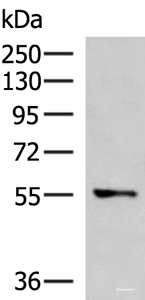 Western blot analysis of A172 cell lysate using TEKT5 Polyclonal Antibody at dilution of 1:800
