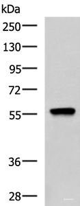 Western blot analysis of A549 cell lysate using TERF1 Polyclonal Antibody at dilution of 1:1000