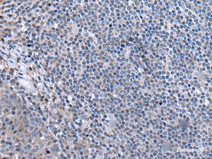 Immunohistochemistry of paraffin-embedded Human tonsil tissue using CCK Polyclonal Antibody at dilution of 1:55. (Original magnific at ion: ×200) at dilution of 1:55 (×200)