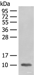 Western blot analysis of Mouse heart tissue lysate using FABP4 Polyclonal Antibody at dilution of 1:400