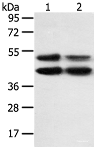 Western blot analysis of K562 and hela cell using MAPK8 Polyclonal Antibody at dilution of 1:600