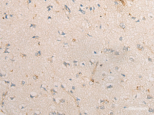 Immunohistochemistry of paraffin-embedded Human brain tissue using PPM1D Polyclonal Antibody at dilution of 1:60 (×200)