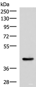 Western blot analysis of Mouse liver tissue lysate using HPN Polyclonal Antibody at dilution of 1:550