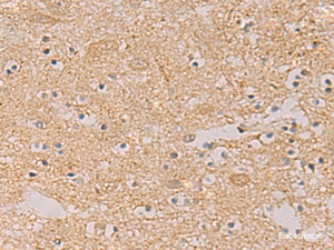 Immunohistochemistry of paraffin-embedded Human brain tissue using PTPRN Polyclonal Antibody at dilution of 1:55 (×200)