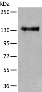 Western blot analysis of Mouse brain tissue lysate using PTPRA Polyclonal Antibody at dilution of 1:400