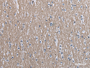 Immunohistochemistry of paraffin-embedded Human brain tissue using SLC39A14 Polyclonal Antibody at dilution of 1:40 (×200)