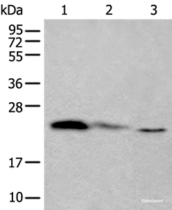 Western blot analysis of 293T and Hela cell lysates using TPT1 Polyclonal Antibody at dilution of 1:450