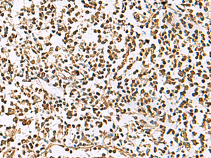 Immunohistochemistry of paraffin-embedded Human tonsil tissue using UBLCP1 Polyclonal Antibody at dilution of 1:85 (×200)