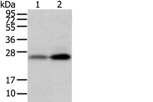 Western blot analysis of Mouse trachea and brain tissue using WFDC5 Polyclonal Antibody at dilution of 1:1100