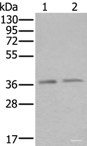 Western blot analysis of Hela and Raji cell lysates using ATXN7L3 Polyclonal Antibody at dilution of 1:500