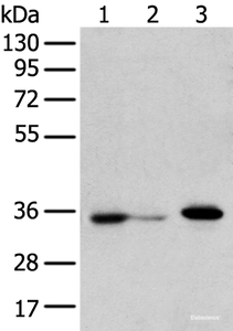 Western blot analysis of HepG2 cell Hela cell and A549 cell using DHRSX Polyclonal Antibody at dilution of 1:350