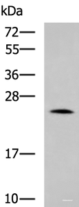 Western blot analysis of Mouse small intestines tissue lysate using LYPLA1 Polyclonal Antibody at dilution of 1:1000