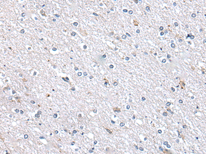 Immunohistochemistry of paraffin-embedded Human brain tissue using METTL7A Polyclonal Antibody at dilution of 1:40 (×200)