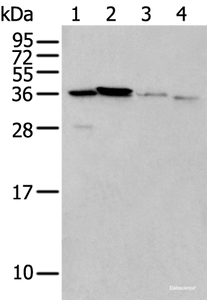 Western blot analysis of 293T cell Mouse brain tissue and Human kidney tissue lysates using LASP1 Polyclonal Antibody at dilution of 1:350