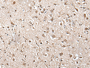 Immunohistochemistry of paraffin-embedded Human brain tissue using ZFP36 Polyclonal Antibody at dilution of 1:55 (×200)