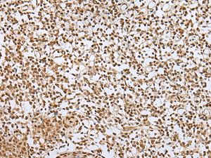 Immunohistochemistry of paraffin-embedded Human tonsil tissue using ZNF354A Polyclonal Antibody at dilution of 1:40 (×200)