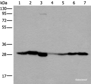 Western blot analysis of Human kidney tissue RAW264.7 cell Mouse kidney tissue Human lung tissue Human fetal liver tissue Hela and 231 cell lysates using VTI1B Polyclonal Antibody at dilution of 1:300